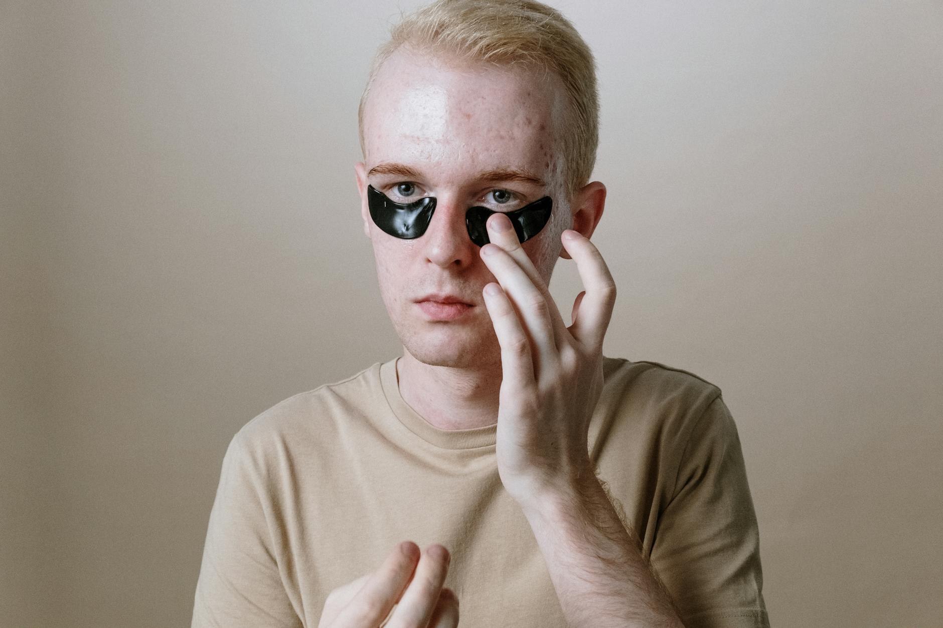 Acne-Fighting Skincare: Gentle Solutions to Clear Skin